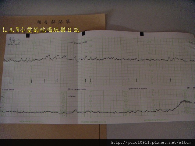 [懷孕日記Wing]34w3d~第八次產檢~做胎盤功能檢測 @貧窮貴婦小愛的吃喝玩樂育兒日記